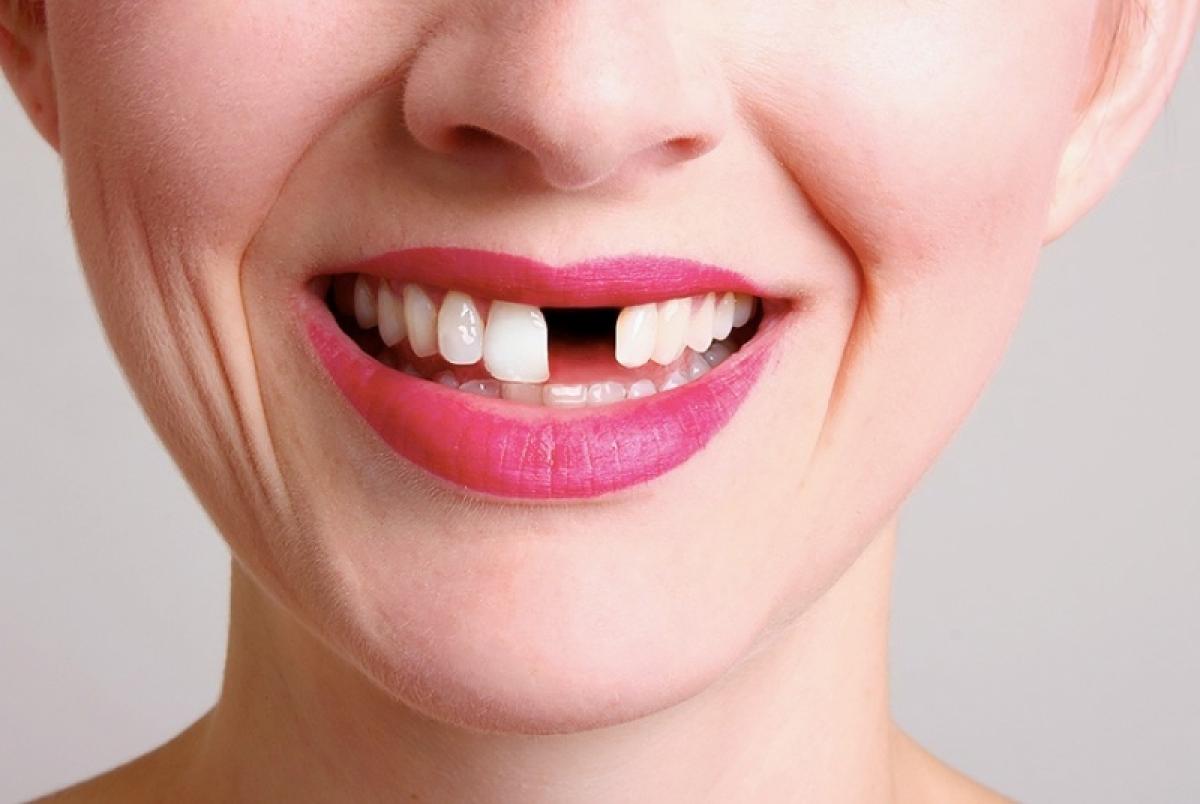 Женщина едва не переломала зубы об пельмени с шурупами