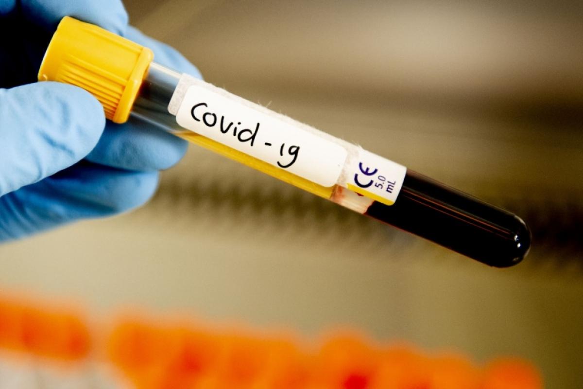 COVID-19 в Саратовской области: 113 заболевших за последние сутки